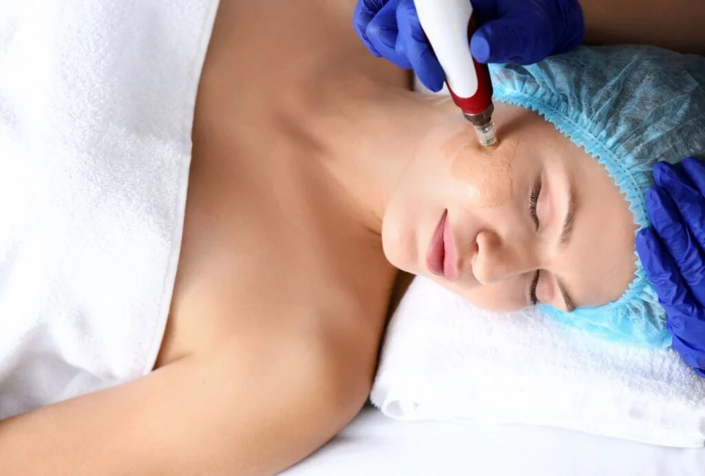 Curso dermapen en Barcelona